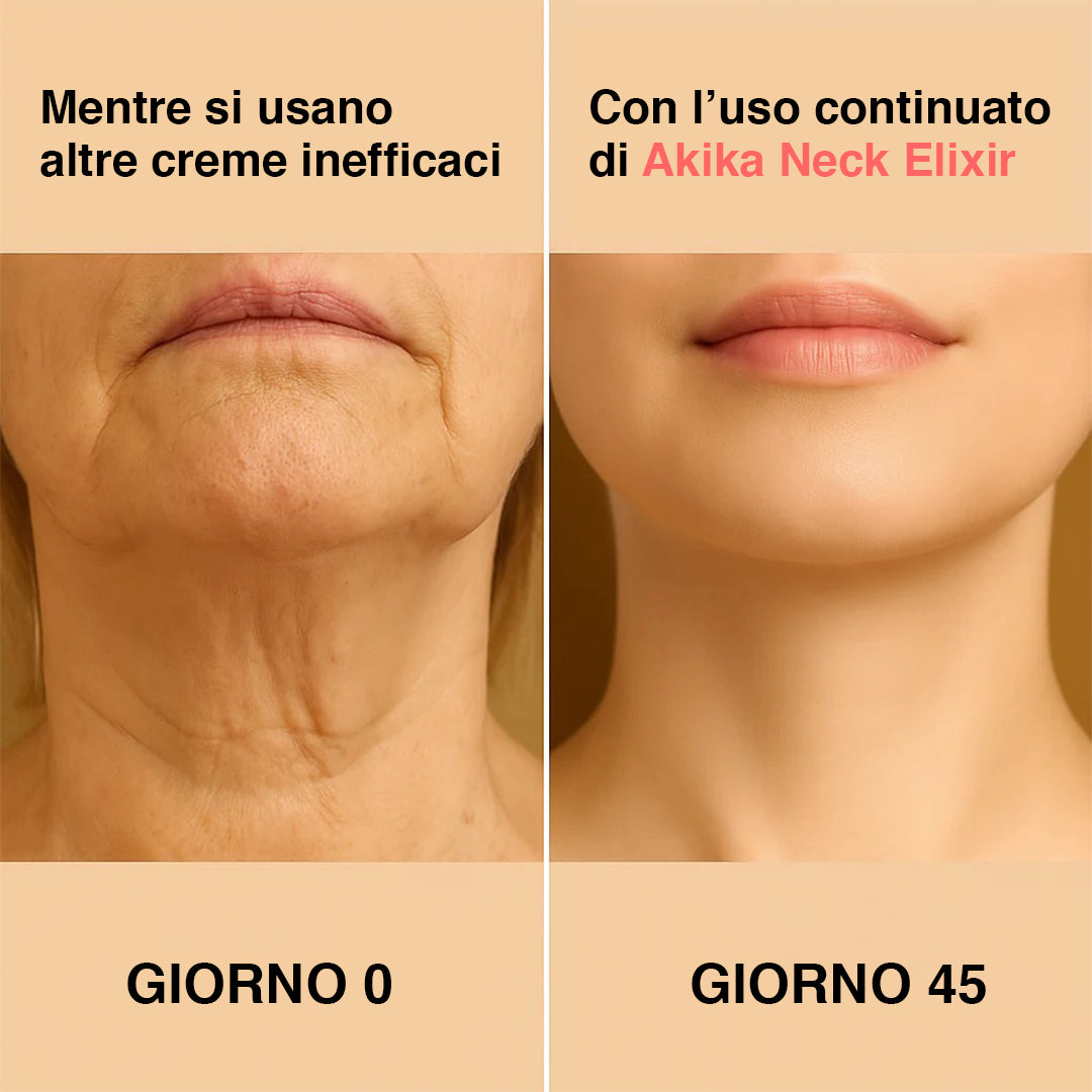 Akika Neck I Elisir NO collo di gallina