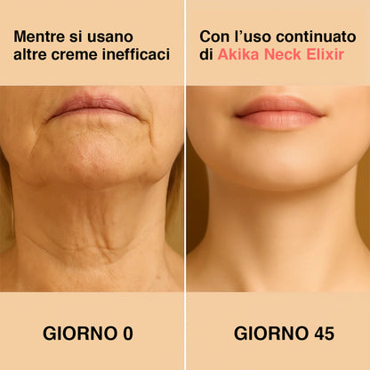Akika Neck I Elisir NO collo di gallina